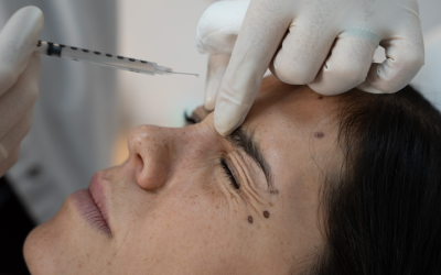 Rejuvenecimiento Natural: Todo sobre los Neuromoduladores en Clínica López-Azpurua